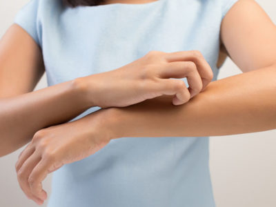 itchy skin and eczema
